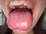 【個人撮影】原美織の舌ブラシで「汚舌苔」採取